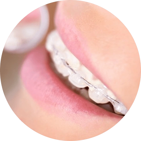 Баннер Поставить брекеты, исправить прикус Баннер Поставить брекеты, исправить прикус