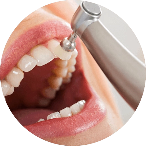 Баннер Чистка зубов Баннер Чистка зубов