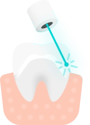 Баннер Коронки из диоксида циркония Баннер Коронки из диоксида циркония
