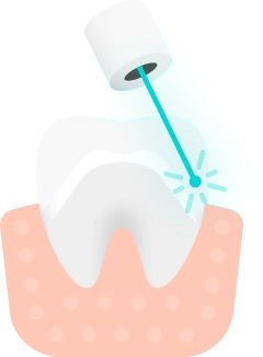 Баннер Металлокерамические коронки Баннер Металлокерамические коронки