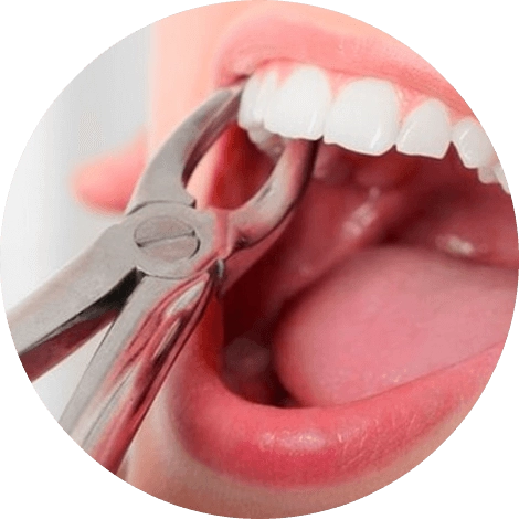 Баннер Удалить зуб Баннер Удалить зуб